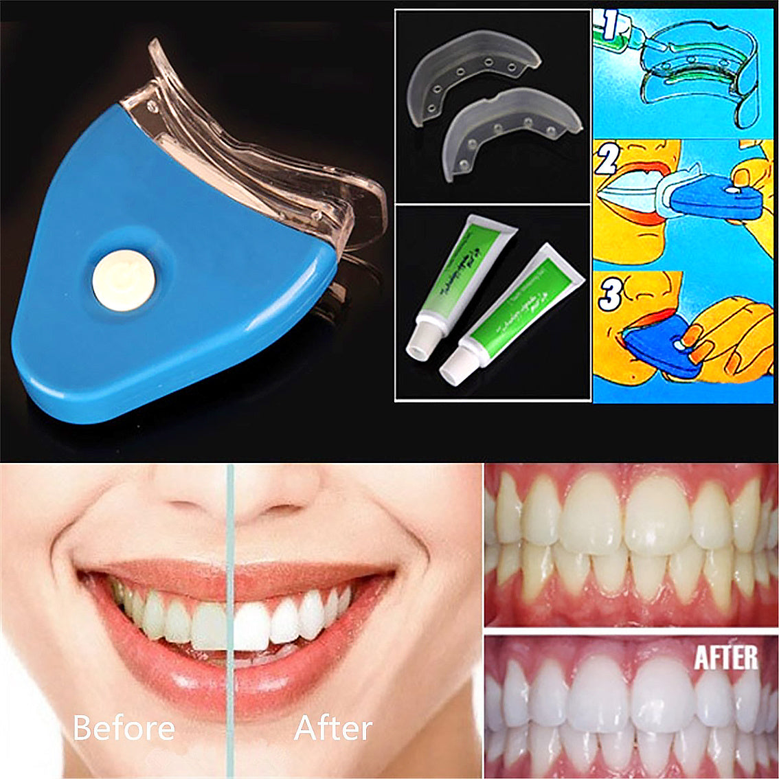 Oral Gel Teeth Whitening LED